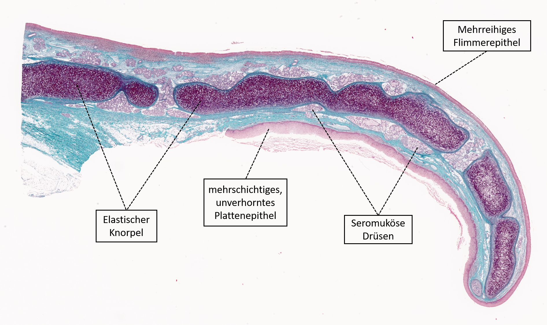 Abbildung Epiglottis