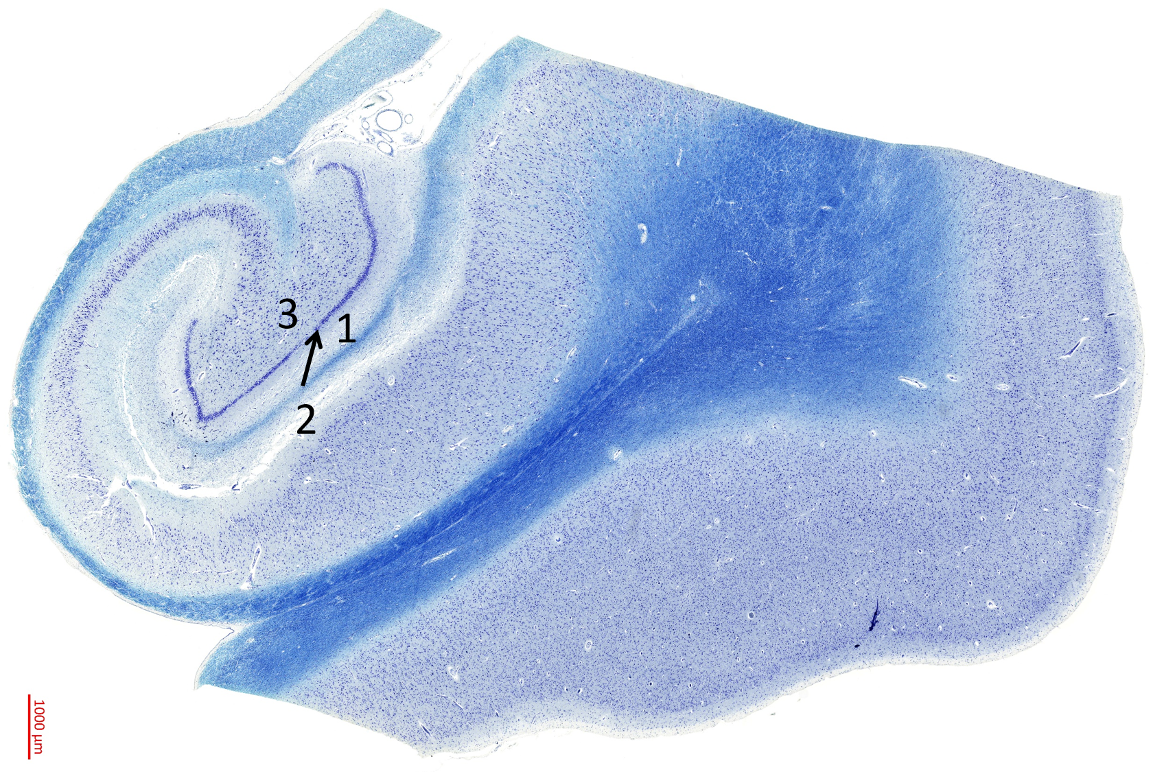 Abbildung 4.2.1. Schichten des Allocortex des Hippocampus